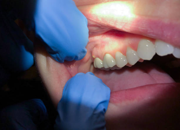 Best Emergency Dental Surgery in Italy, TX